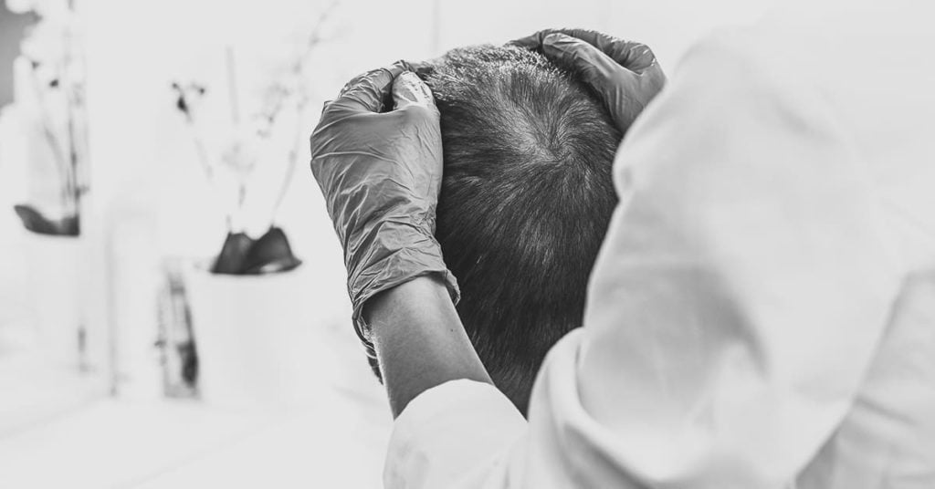 Amantide | il trapianto di capelli in Turchia
