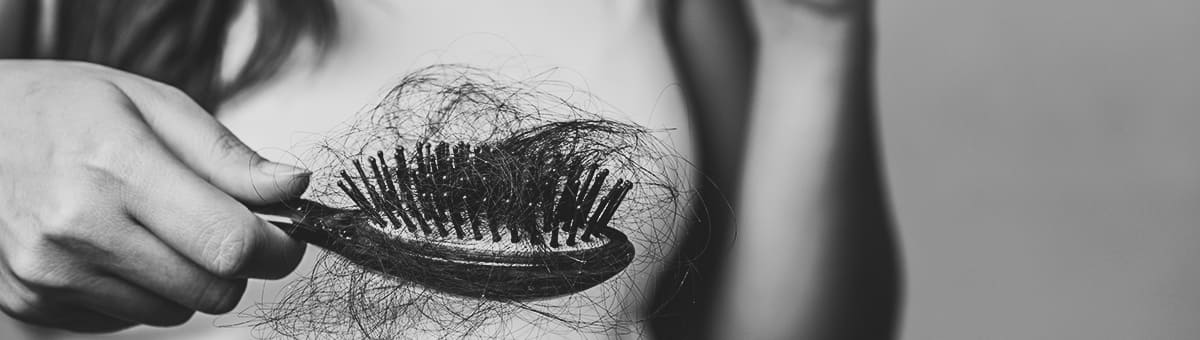 Amantide | Alopecia