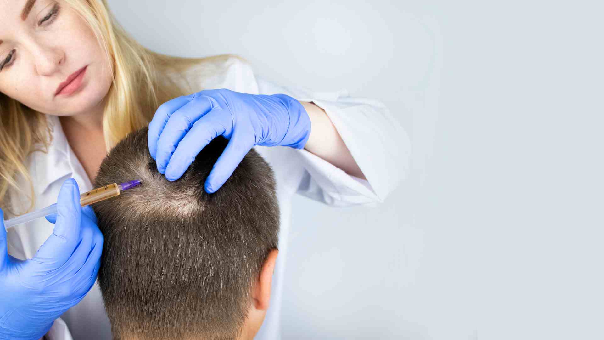 Alopecia Androgenetica / Aerata / da Stress
