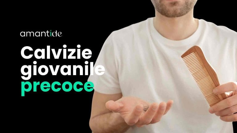 Calvizie Giovanile Precoce
