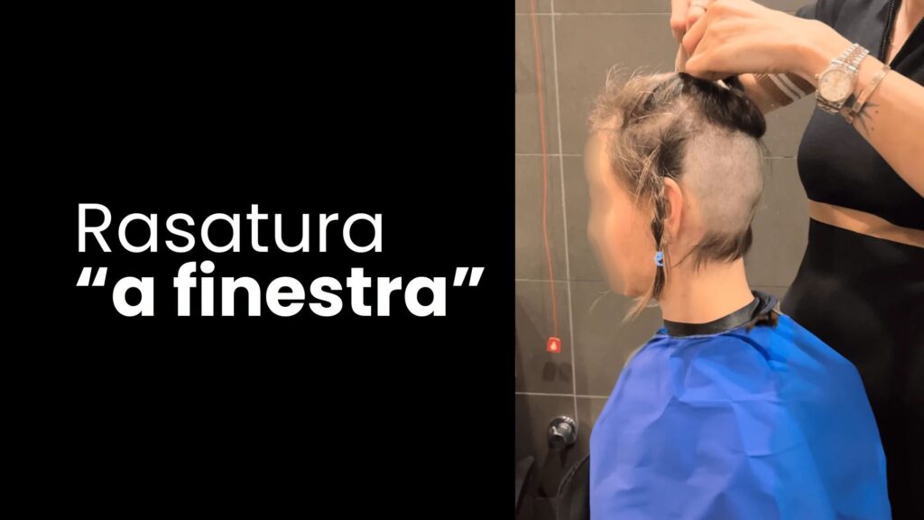 alopecia femminile