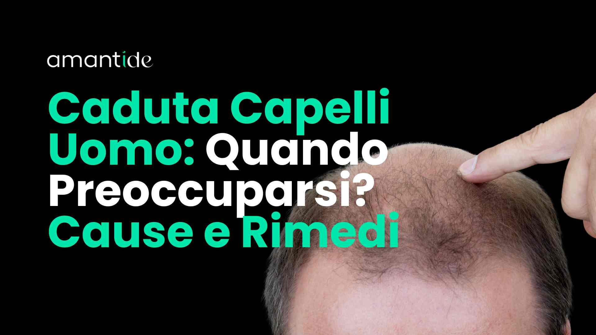 Caduta Capelli Uomo - Amantide