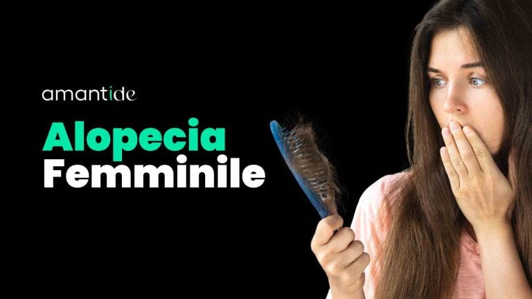 Alopecia Femminile