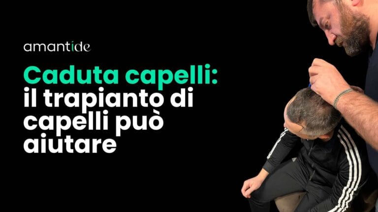 Caduta capelli: il trapianto di capelli può aiutare