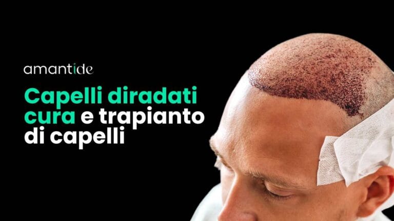Capelli diradati cura e trapianto di capelli