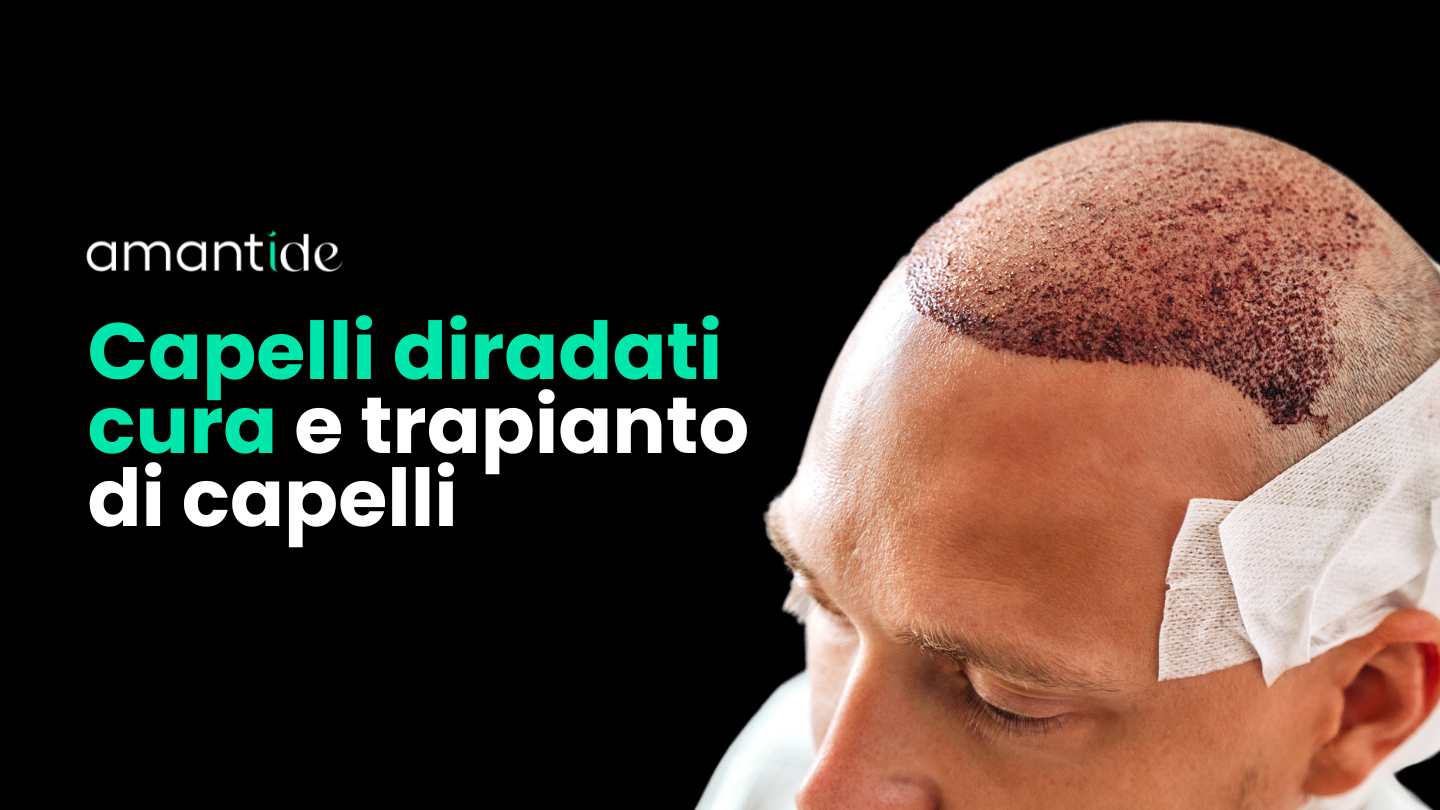 capelli diradati cura | amantide