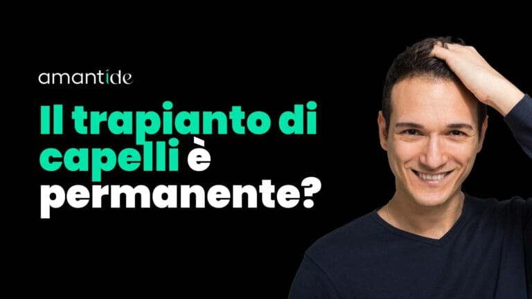 Il trapianto di capelli è permanente?
