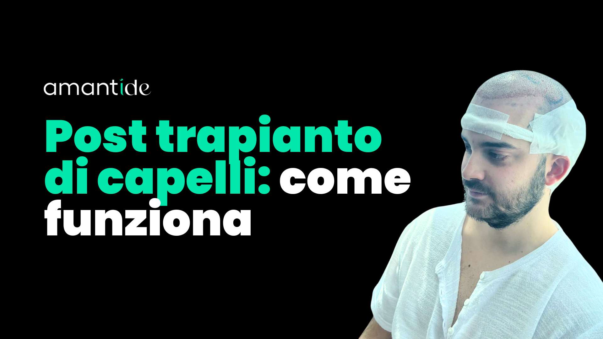 post trapianto di capelli come funziona | amantide