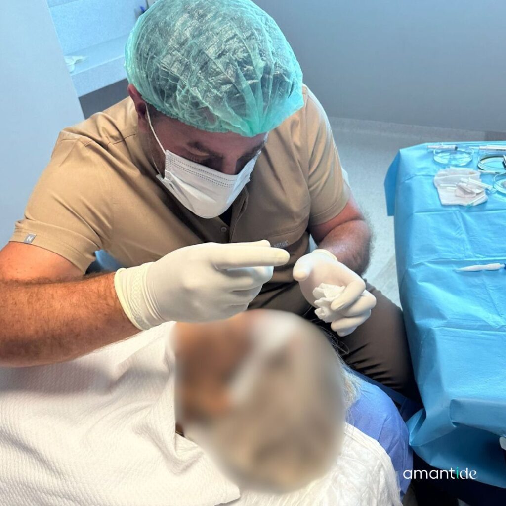 trapianto di sopracciglia | operazione | amantide