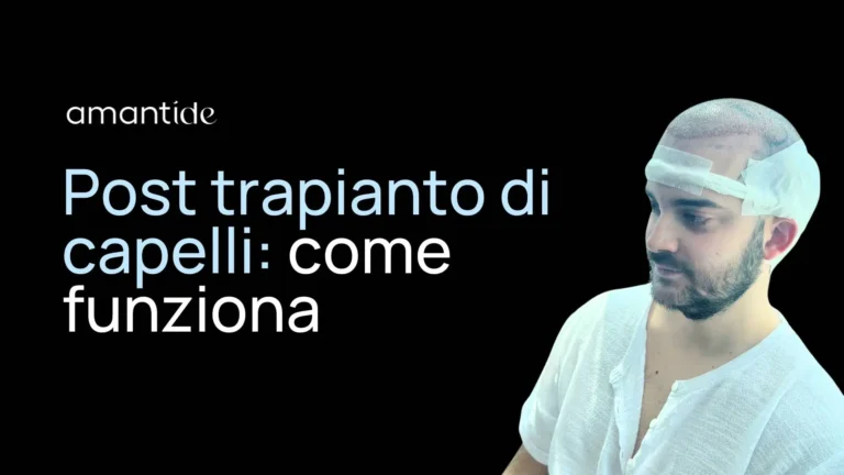 Post trapianto di capelli: come funziona