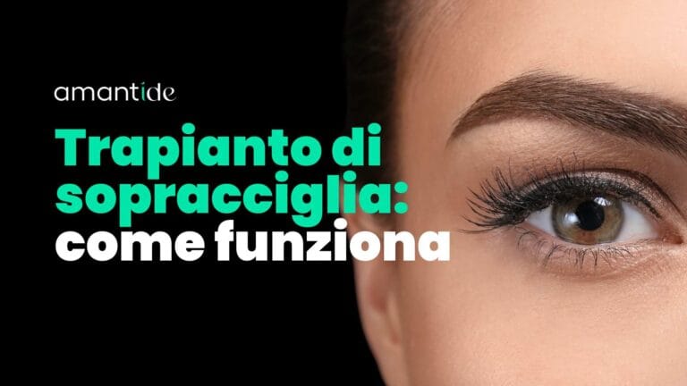 Trapianto di sopracciglia: come funziona