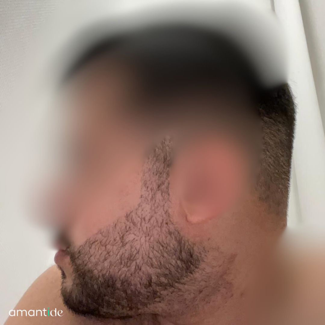 trapianto barba turchia funziona