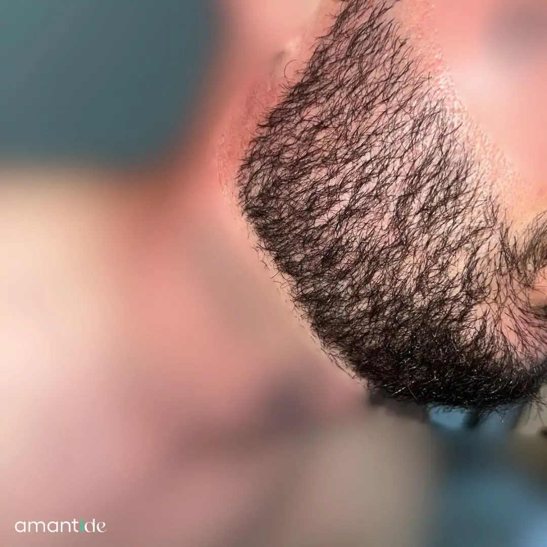 Prima e dopo barba 4