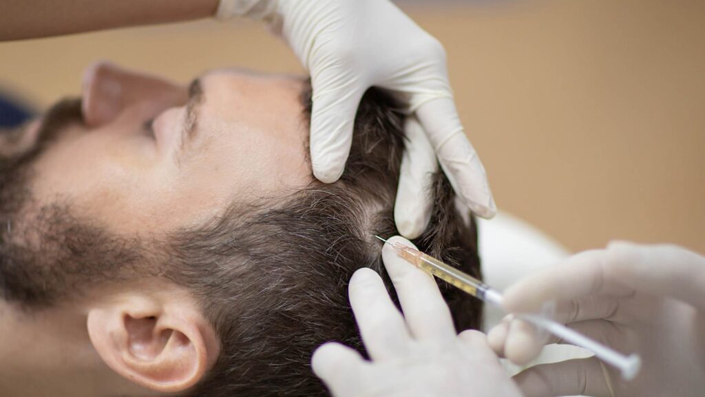 prp capelli | amantide | trapianto di capelli in turchia