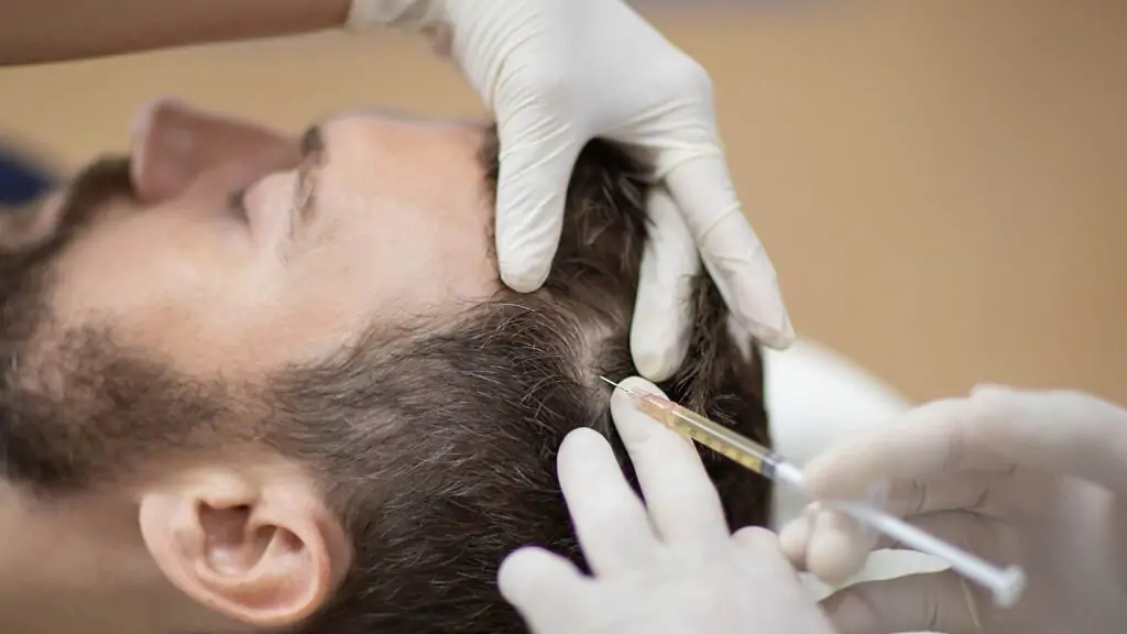 prp capelli | amantide | trapianto di capelli in turchia