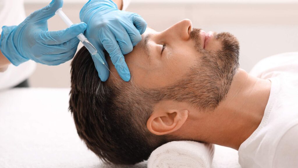 iniezione esosomi capelli | amantide