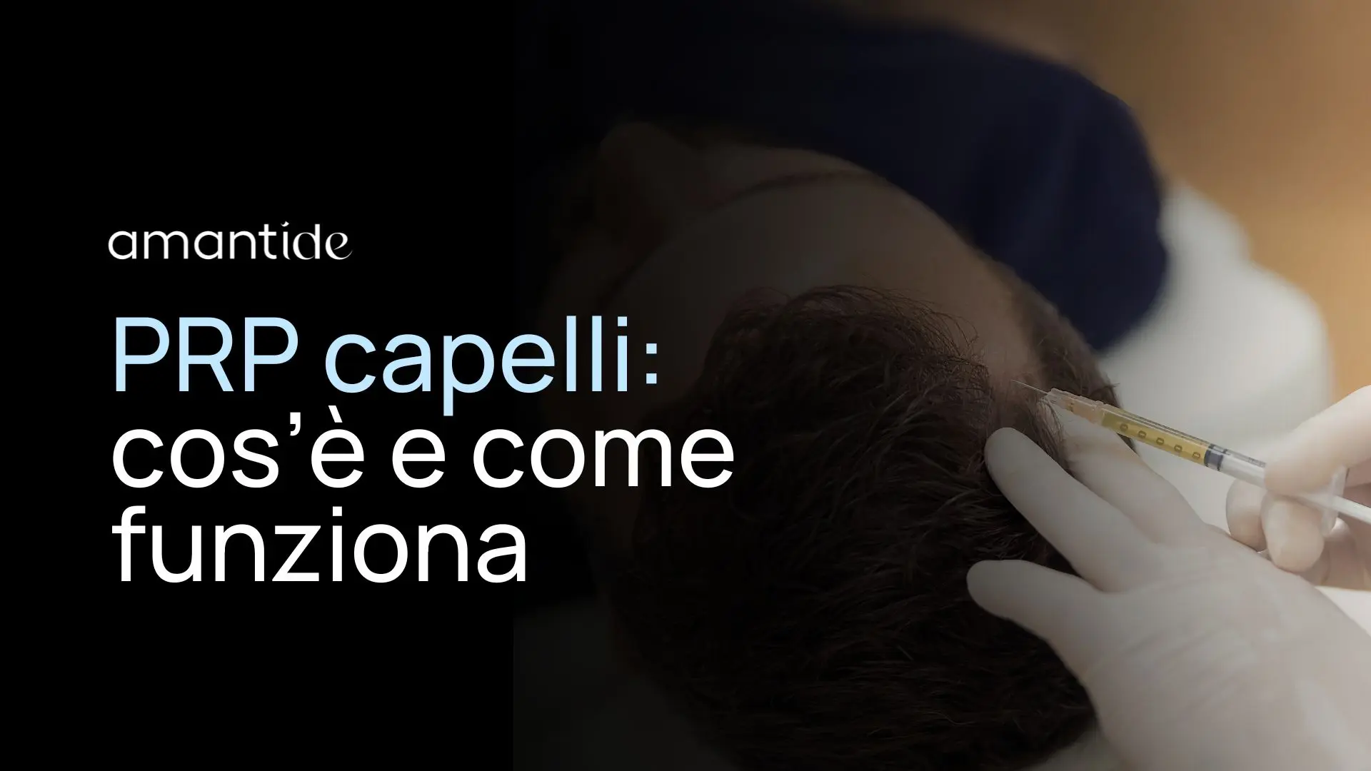 prp capelli cos'è e come funziona | amantide