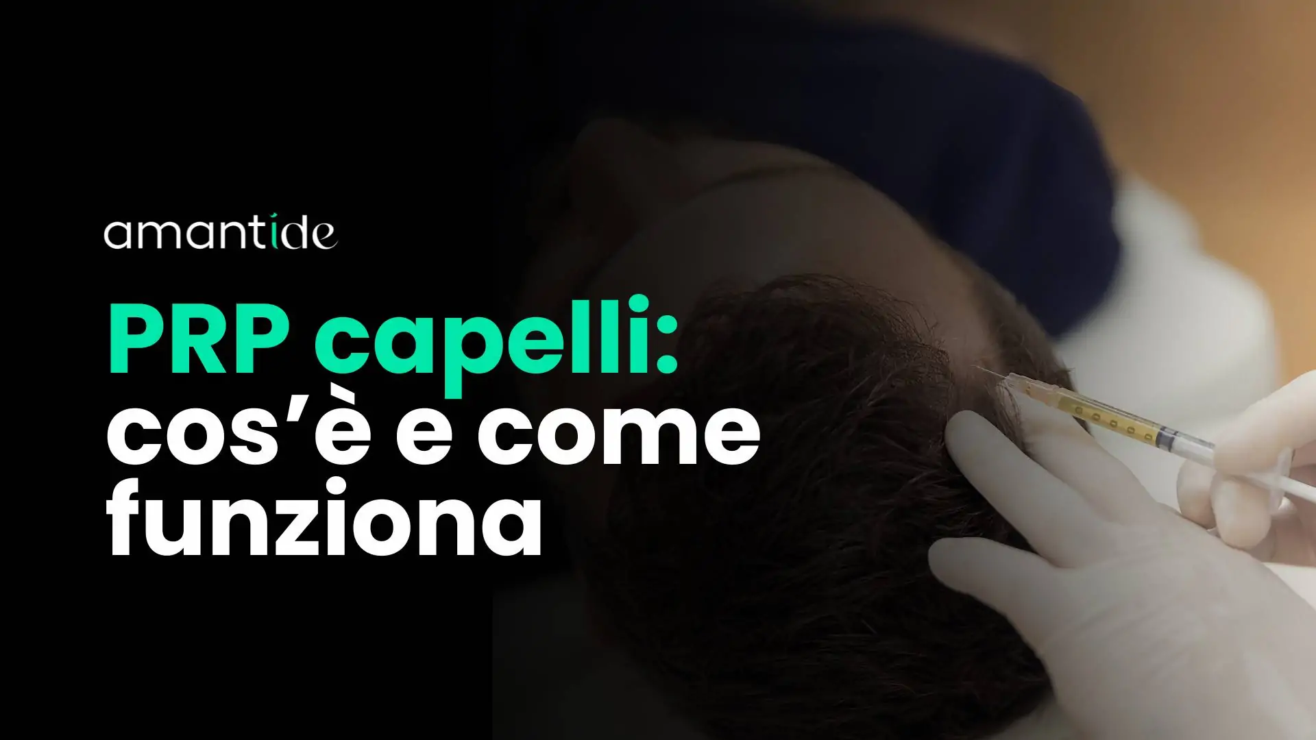 prp capelli cos'è e come funziona | amantide
