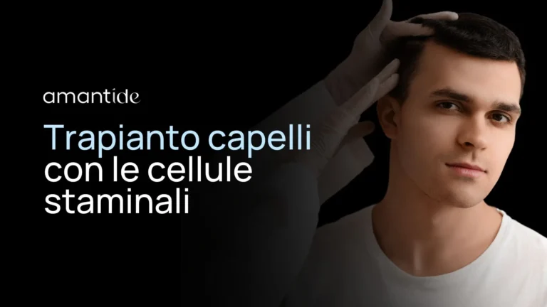 Trapianto capelli con le cellule staminali