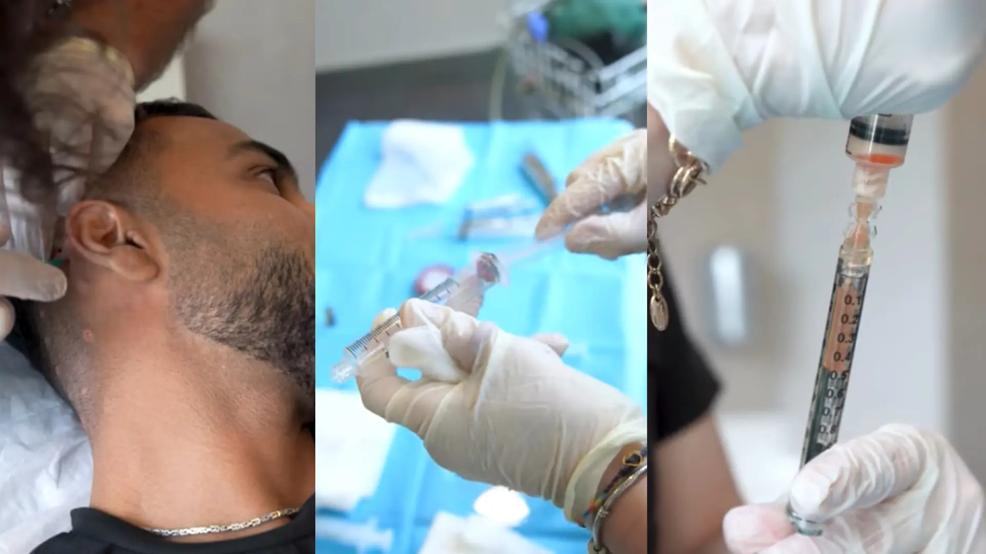 Cellule staminali per capelli