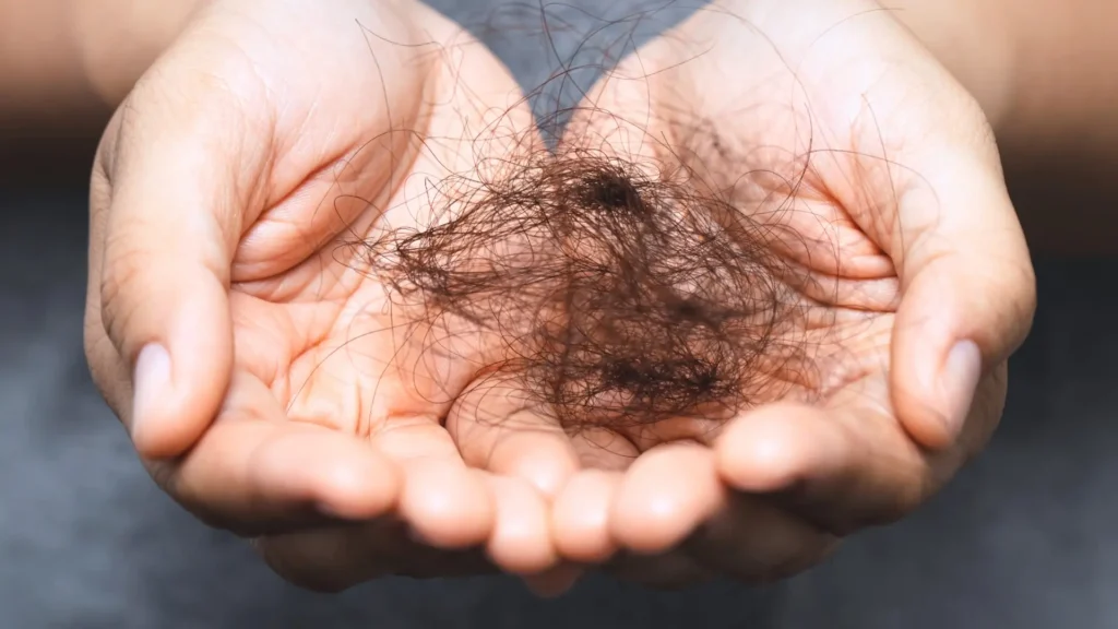 quando la caduta dei capelli diventa un segnale da non ignorare | amantide