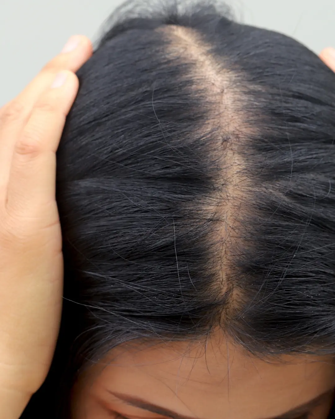 Segnali caduta capelli