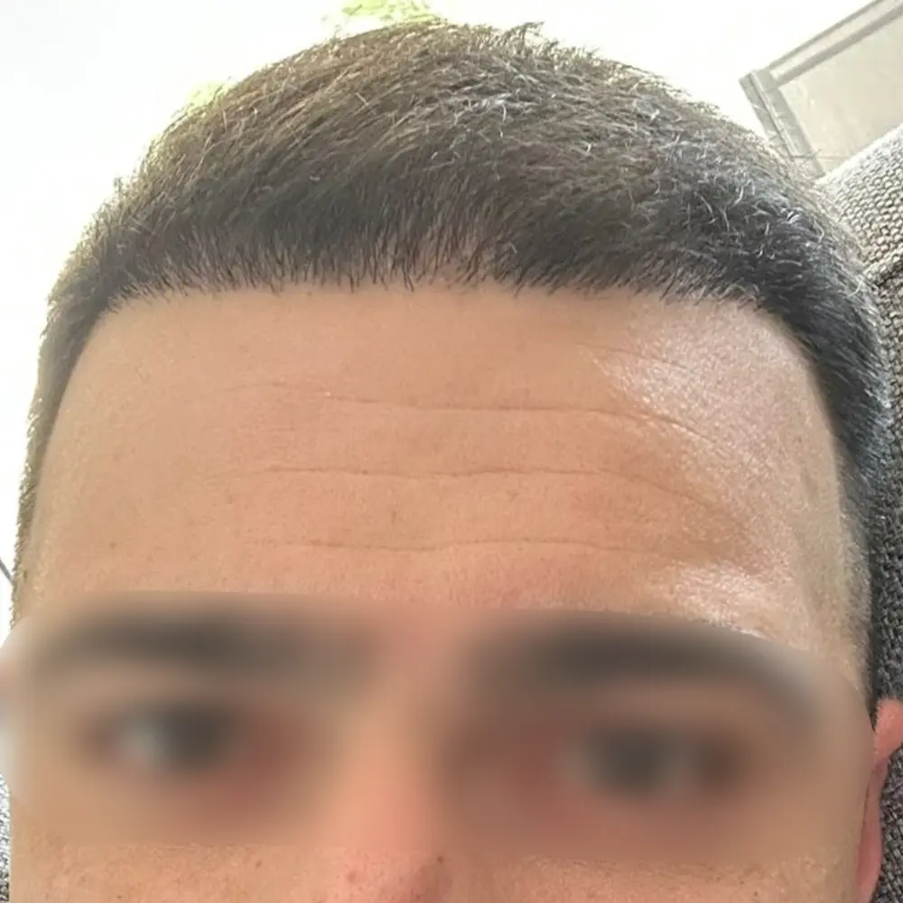 Frontale risultato
