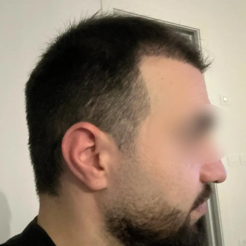 Laterale risultato