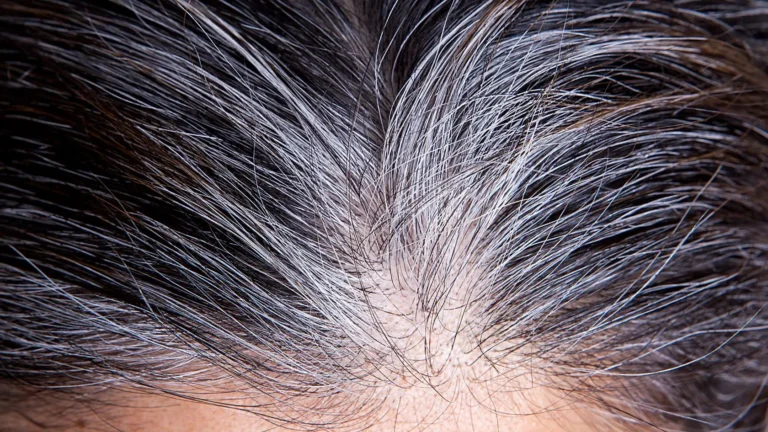 Capelli bianchi: cause, rimedi e come rallentarli