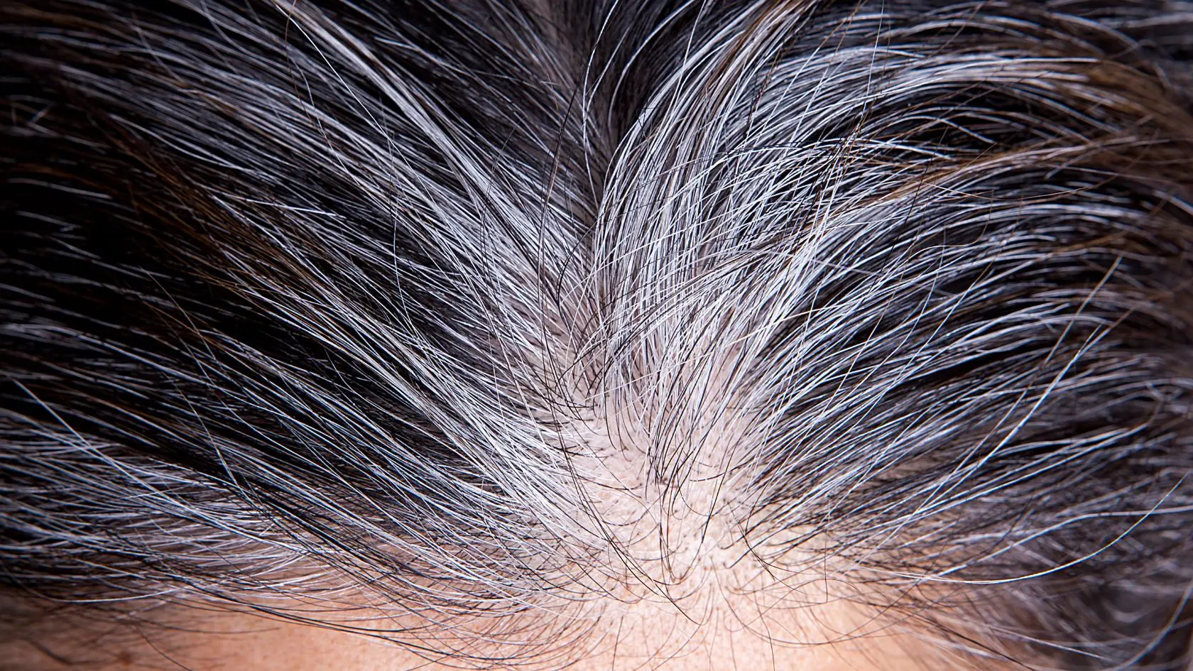Capelli bianchi: cause, rimedi e come rallentarli