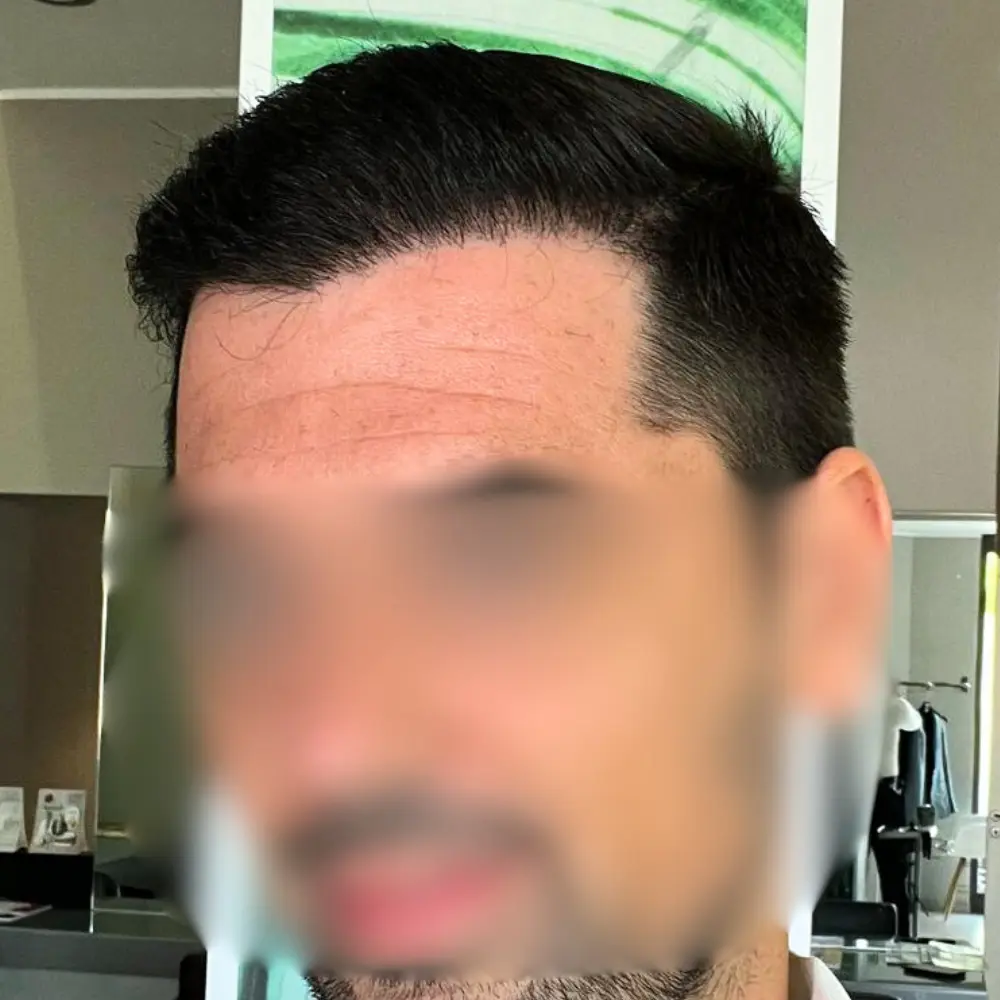 Dopo - Alberto