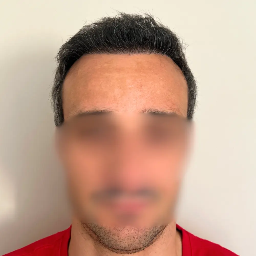 Dopo - Alessio