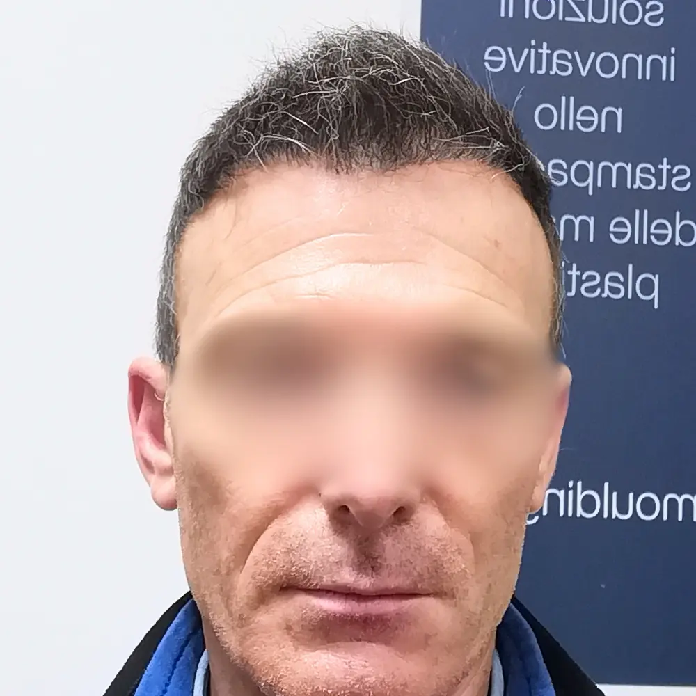 Dopo - Francesco
