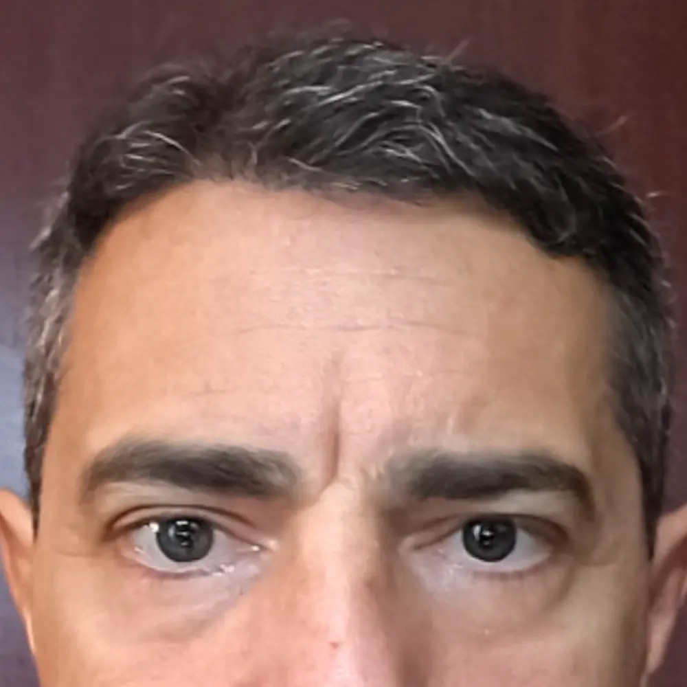 Dopo - Michele