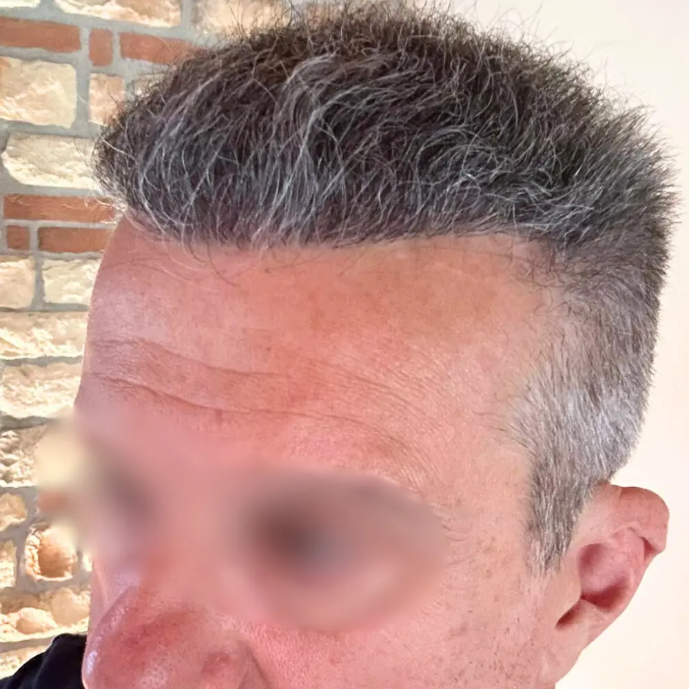 Dopo - Roberto