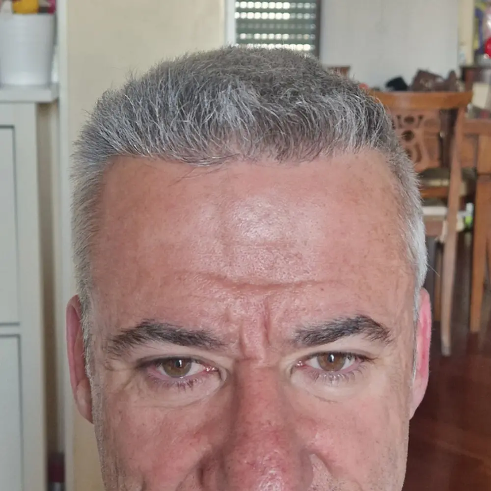 Frontale risultato