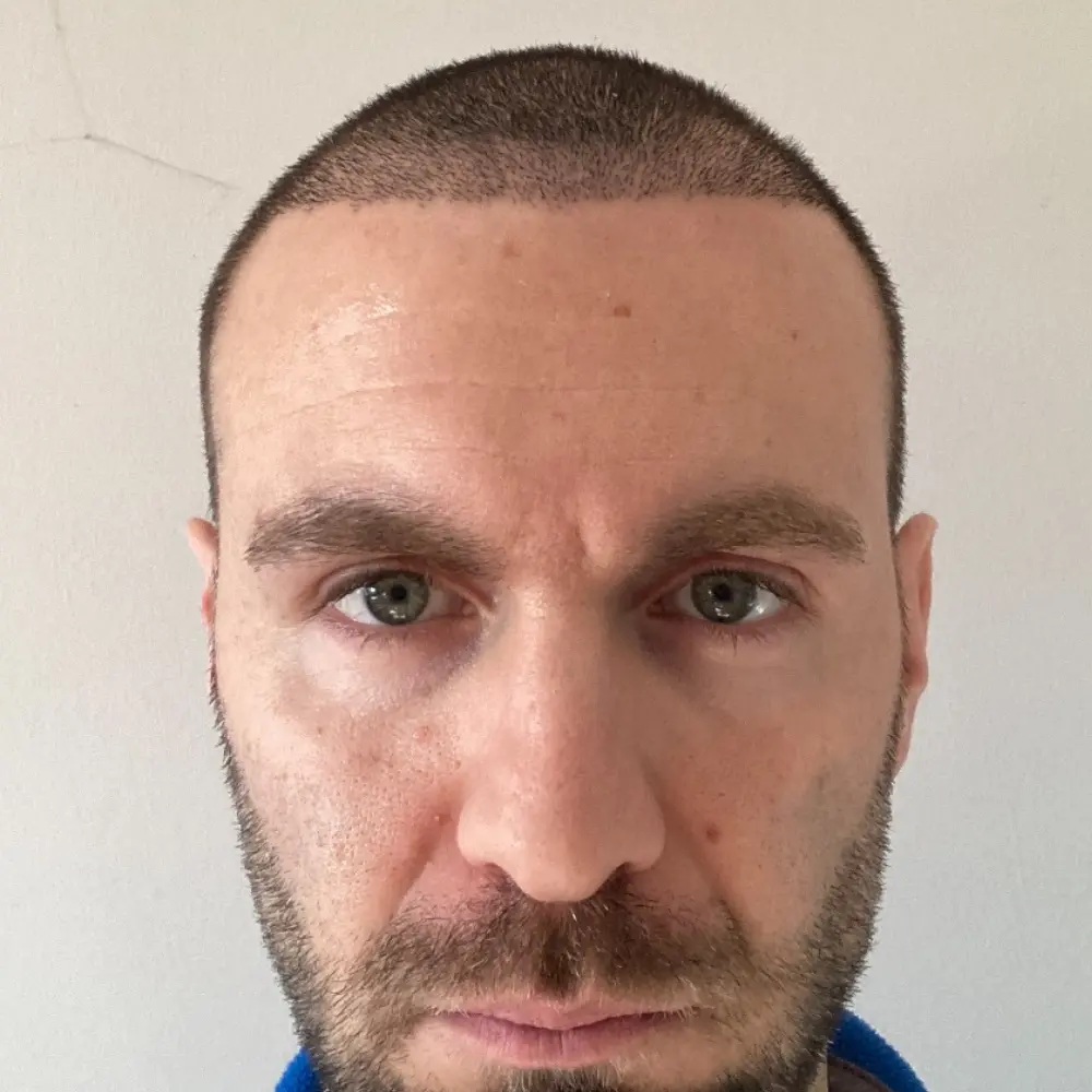 Frontale post-intervento