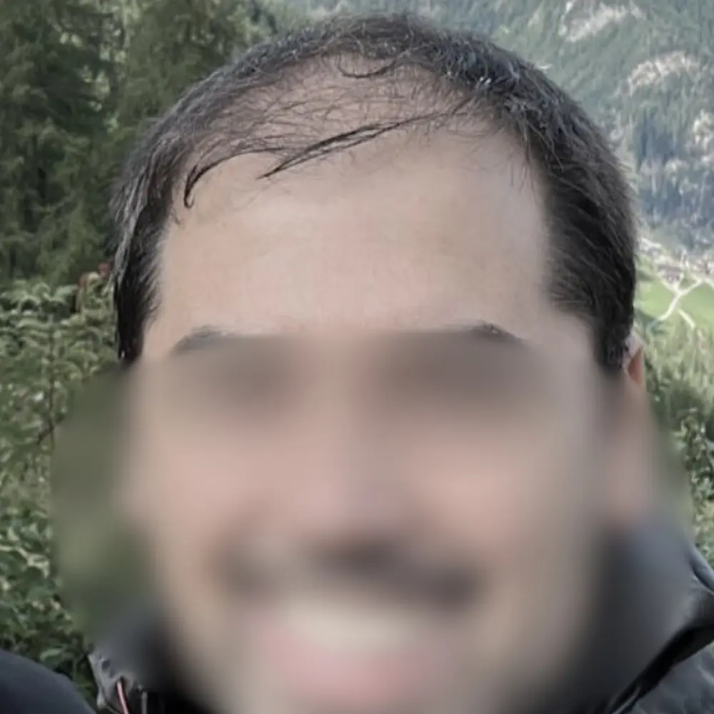 Prima - Alberto