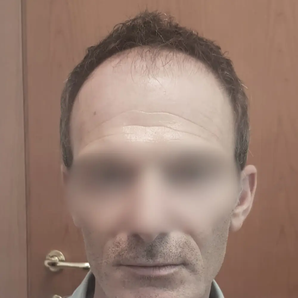Prima - Francesco