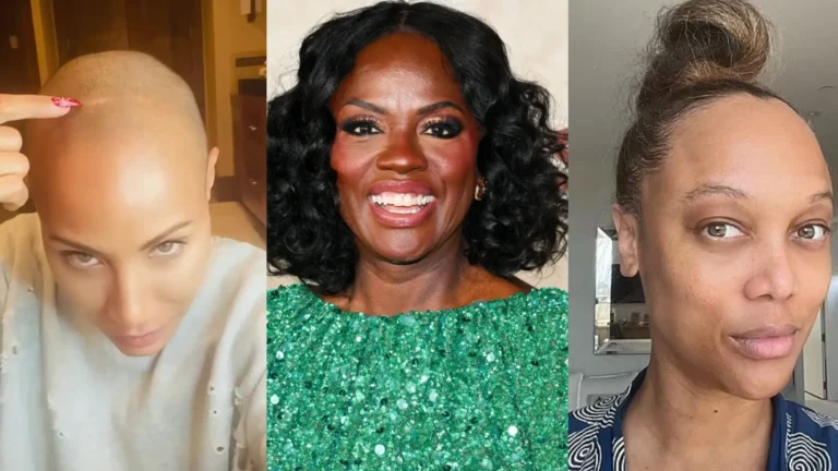Alopecia donne famose: chi ha parlato della caduta capelli