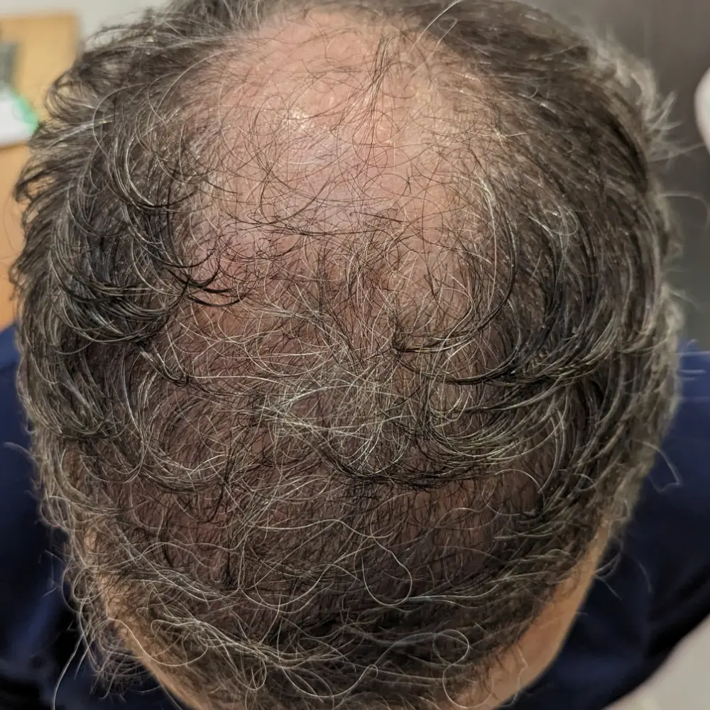 Dopo